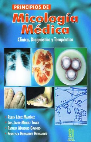 PRINCIPIOS DE MICOLOGIA MEDICA. CLINICA DIAGNOSTICO Y TERAPEUTICA