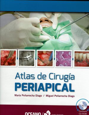 Atlas de cirugía periapical c / CD-ROM