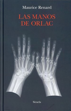 Las manos de Orlac / pd.