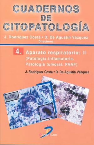 Cuadernos de Citopatología / Vol. 4. Aparato respiratorio. Vol II. Patología inflamatoria Patología tumoral: PAAF