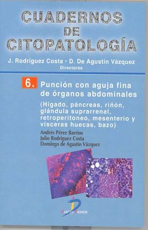 Cuadernos de Citopatología / Vol. 6. Punción con aguja fina de órganos abdominales