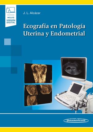 Ecografía en patología uterina y endometrial / pd. (Incluye versión digital)