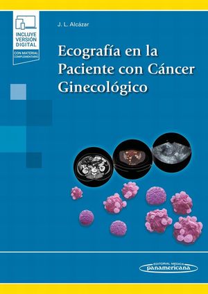 Ecografía en la paciente con cáncer ginecológico / Pd. (Incluye versión digital)