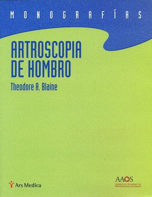 ARTROSCOPIA DE HOMBRO