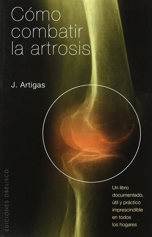 Cómo combatir la artrosis