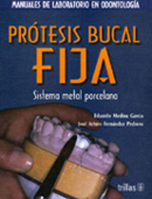 PROTESIS BUCAL FIJA. SISTEMA METAL PORCELANA Y COLLARLESS