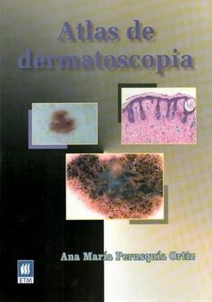 Atlas de dermatoscopía / Pd.