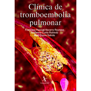 IBD - CLINICA DE TROMBOEMBOLIA PULMONAR
