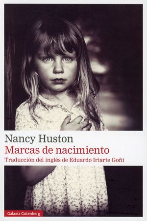 Marcas De Nacimiento