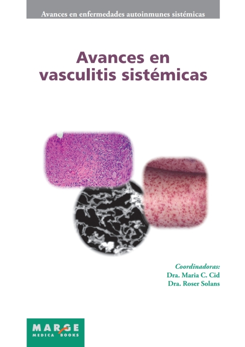 Avances En Vasculitis Sistémicas