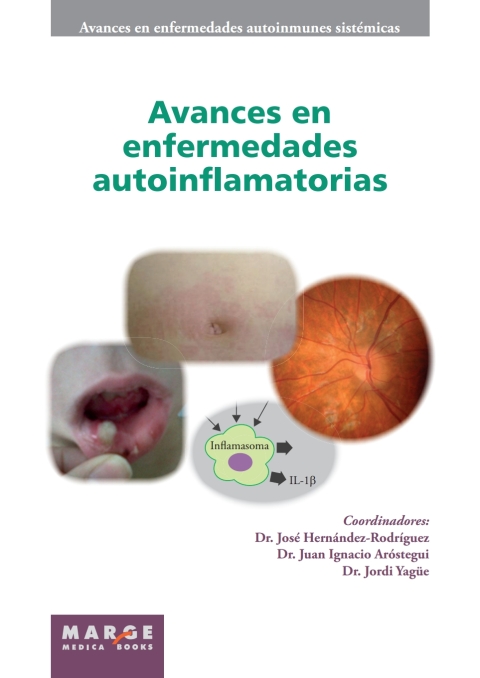 Avances En Enfermedades Autoinflamatorias