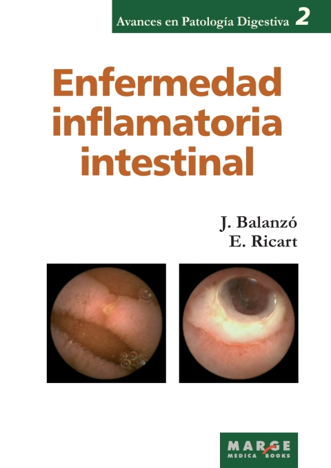 Enfermedad Inflamatoria Intestinal
