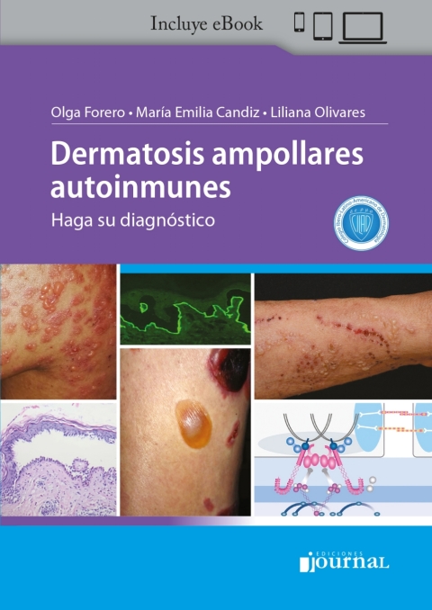 Dermatosis Ampollares Autoinmunes